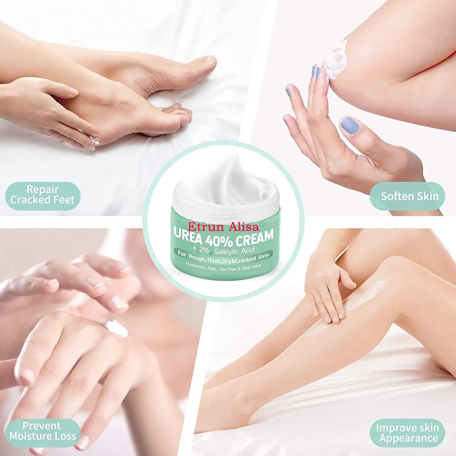 OEM Hand Foot Care Moisturizing Nourishing Removal Callus Peel Crack 2% Salicylic Acid Urea 40% Cream